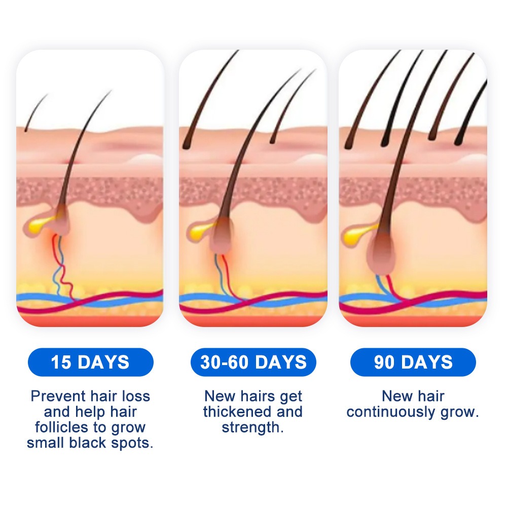 Spray na porost włosów przy al – Hair Care Spray recenzja i cena